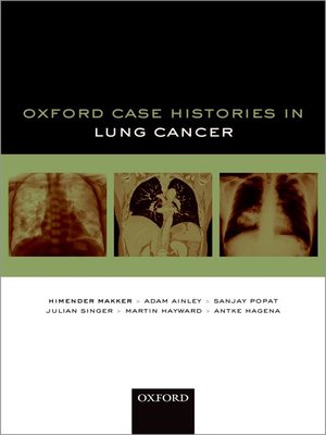 cover image of Oxford Case Histories in Lung Cancer